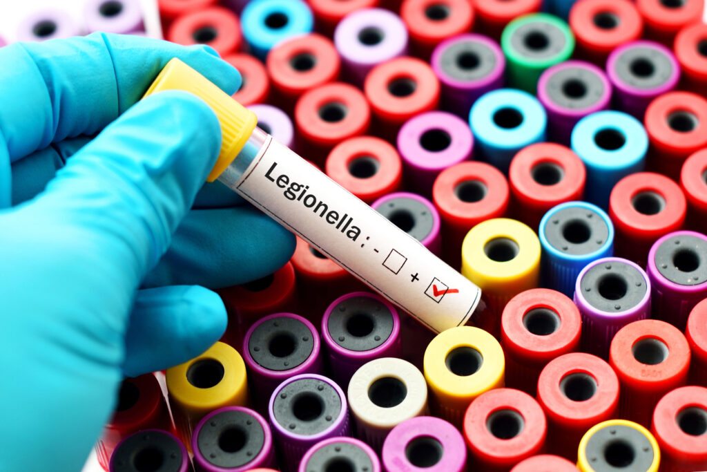 alt="How To Remove Legionella From Your Supply"