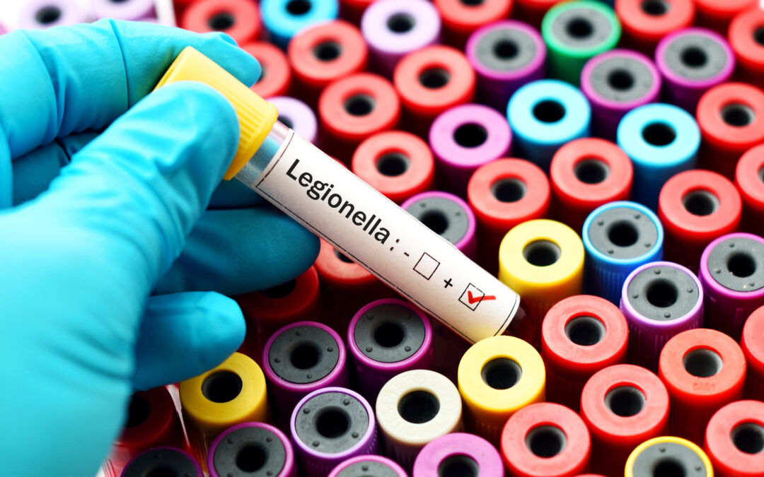 How To Remove Legionella From Your Supply